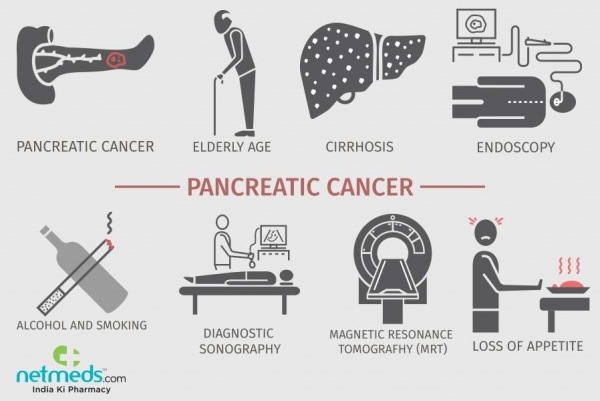 سرطان پانکراس یا لوزالمعده